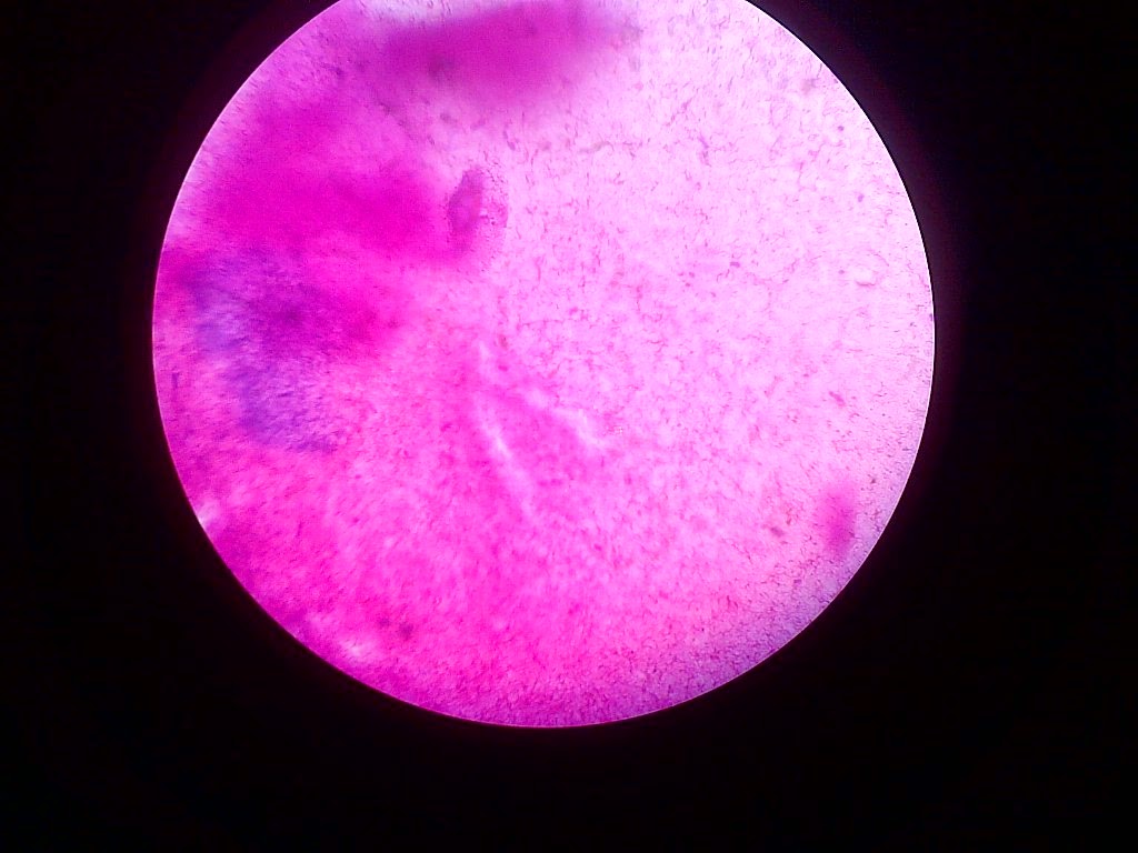 it�s my life: PEWARNAAN GRAM DAN PENGAMATAN MORFOLOGI BAKTERI