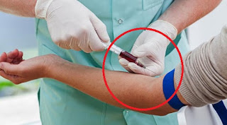 Inilah 6 Alasan Mengapa Tes Darah itu Sangat Penting