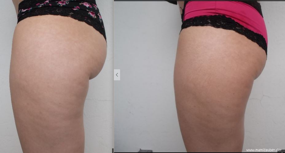 Oberschenkel Abnehmen Frischhaltefolie Diatplan Fur Ektomorph Um Muskeln Aufzubauen