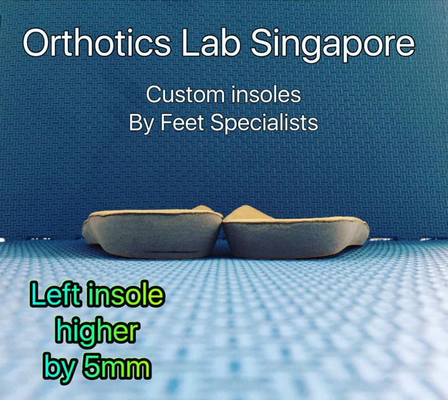 Custom Orthotics Insoles Orthotics Lab Singapore