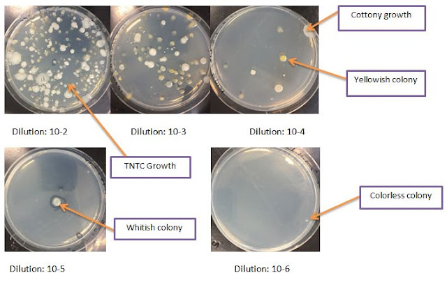 Isolation and Identification of microorganisms from soil sample