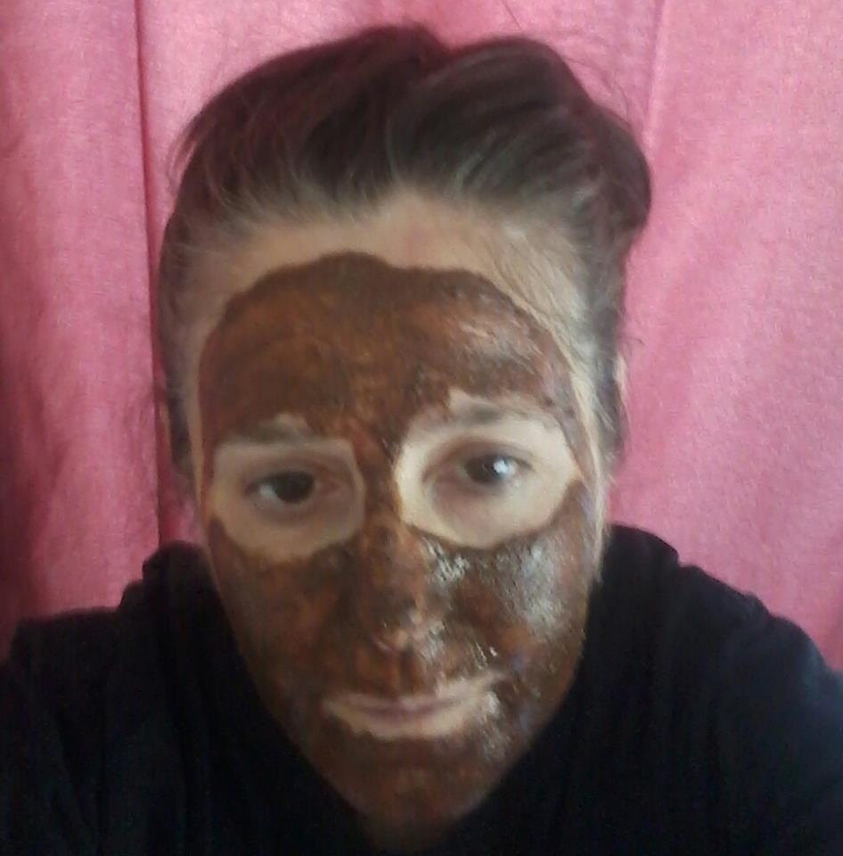 Triggers For Rosacea Coffee And Chocolate