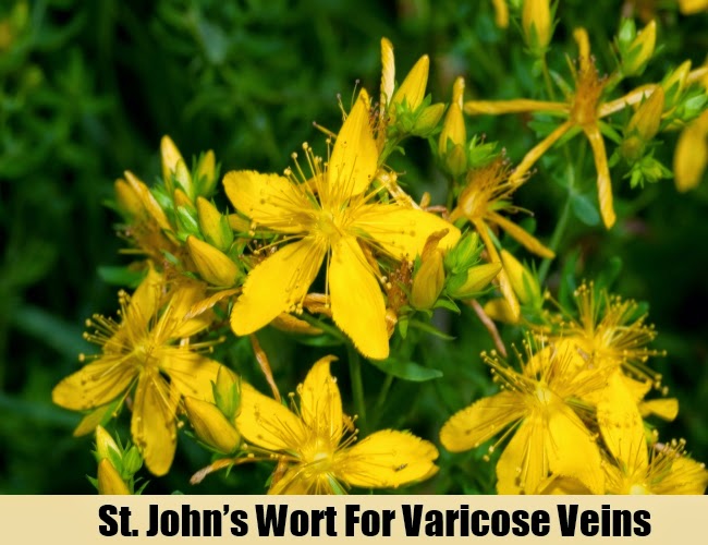 9 HERBAL REMEDIES FOR VARICOSE VEINS Mzizi Mkavu