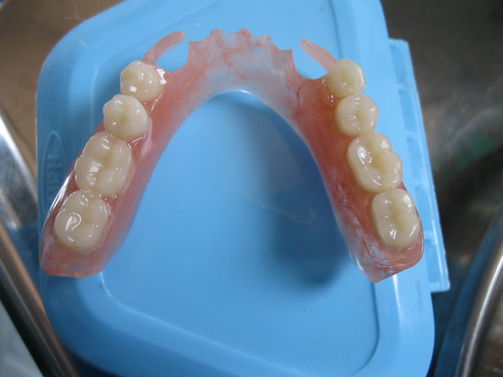 Съемный протез (6-14 зубов) термо Джет