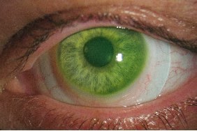 an introduction to scleral