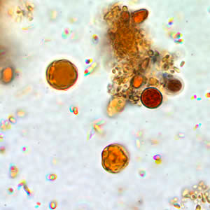 Blastocystis hominis parazit