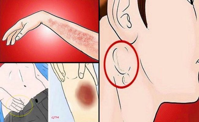 http://3.bp.blogspot.com/-KlZpqjxC8X8/WJxpRiXeEOI/AAAAAAAABeM/y0MyUnnYhDo17lCN7DXk3MbGHMLzEHsagCK4B/s1600/15%2BCancer%2BWarning%2BSigns%2BPeople%2BIgnore%2BUntil%2BIt%25E2%2580%2599s%2BToo%2BLate.jpg