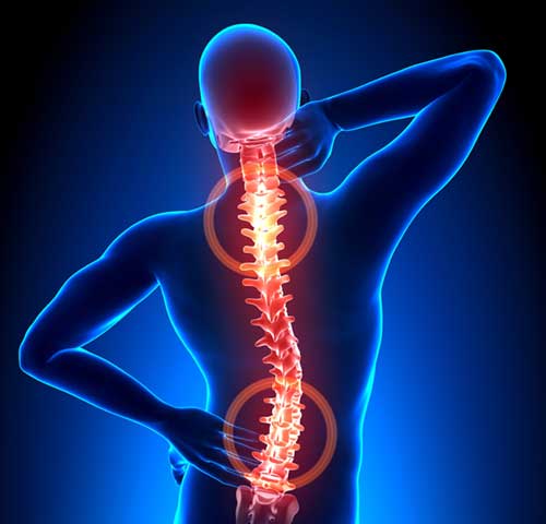 reversing degenerative disc disease Degenerative disc arthritis ddd ...