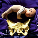 Doctor Was Surprised: Transverse Baby Went Head down at Term Spinning Babies Spinning Babies offers an uncommon strategy: