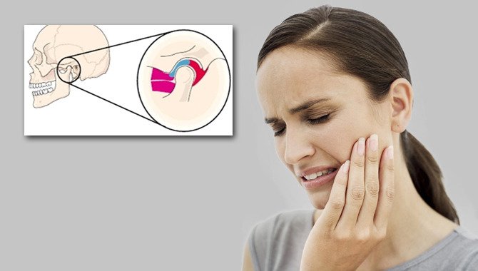 Tensión dolor de cabeza y mareos visión borrosa Tensión dolor de cabeza y mareos visión borrosa