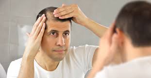 Hair Loss Treatments For Men Daily Health Tips