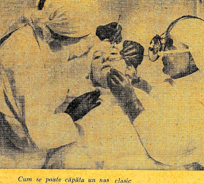 Rinoplastie 1931