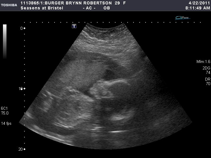 Family Pack of Burgers April 2011