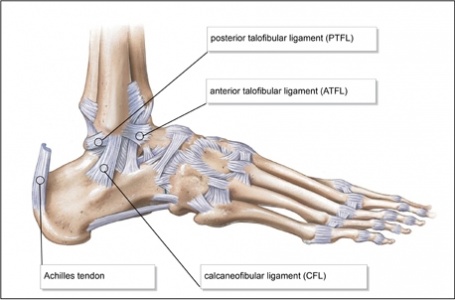 Kenőcs sprains és sprains - Diagnosztika July - A sprain traumás ízületi sérülés