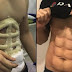 Un hôpital offre maintenant de vous greffer des abdos musclés instantanément.
