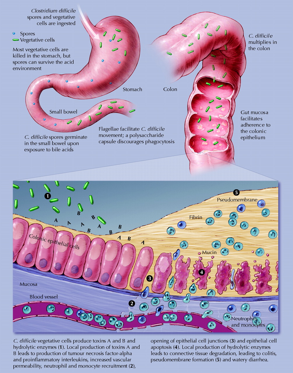 El mundo de las bacterias clostridium difficile