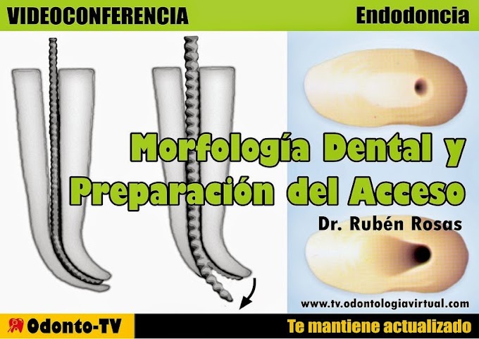 WEBINAR: Morfología Dental y Preparación del Acceso en Endodoncia - Dr. Rubén Rosas