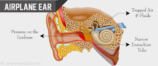 Patofisiologi Barotrauma atau Airplane ear