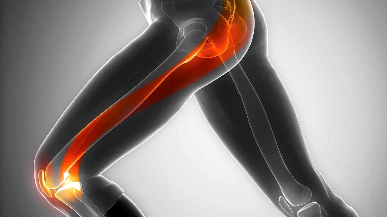 It Band Knee Pain Treatment