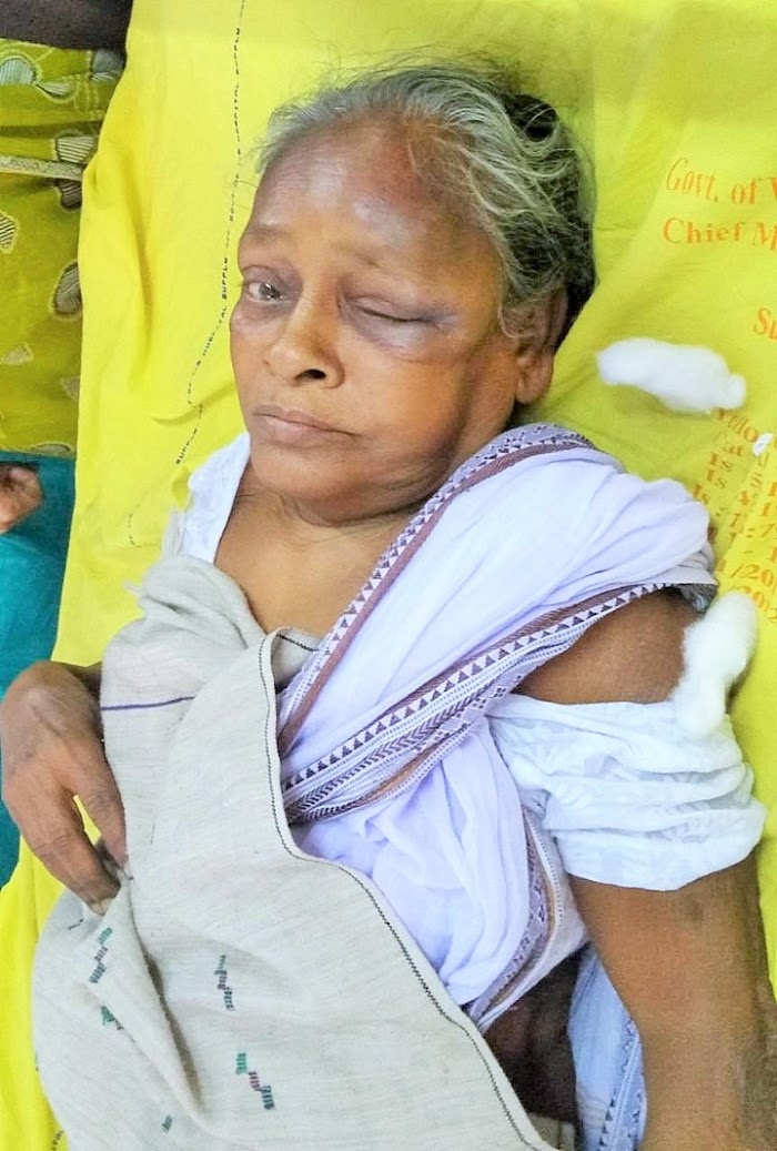 ফের লুটের উদ্দেশ্যে কালনায় ফাঁকা বাড়িতে বৃদ্ধার উপর প্রাণঘাতী হামলা দুষ্কৃতিদের