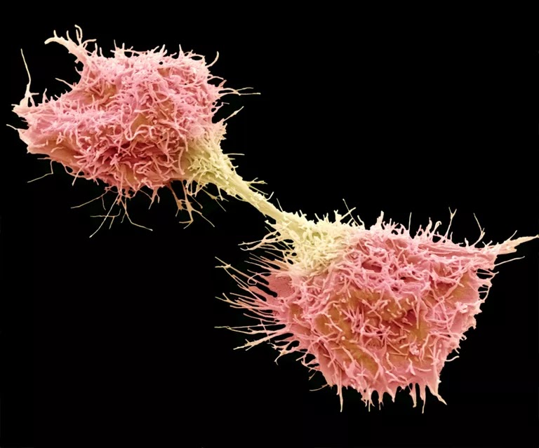 10 حقائق عن خلايا السرطان - Cancer Cells