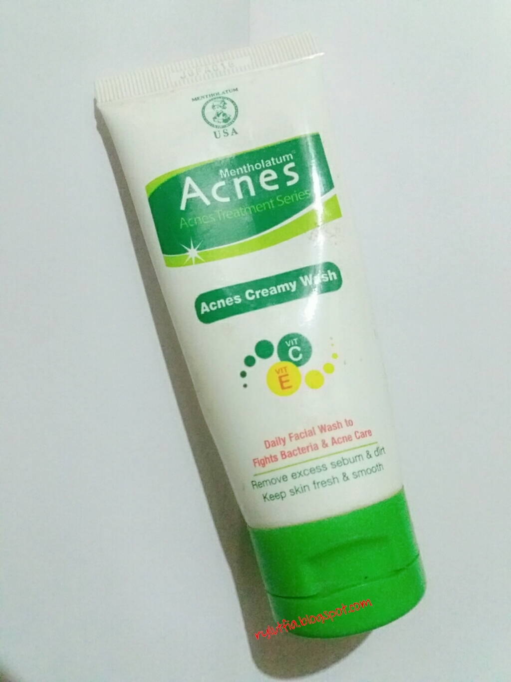 Review Acnes Creamy Wash Untuk Menghilangkan Jerawat Shineon