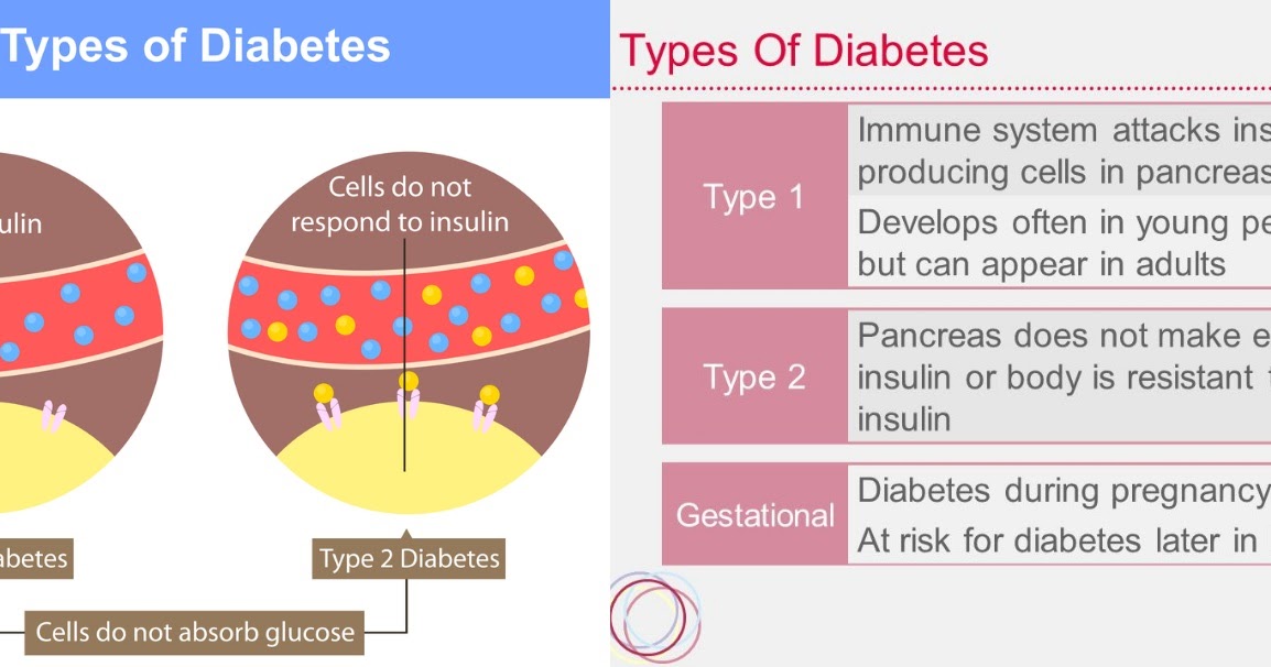 Definition and Types of Diabetes Mellitus