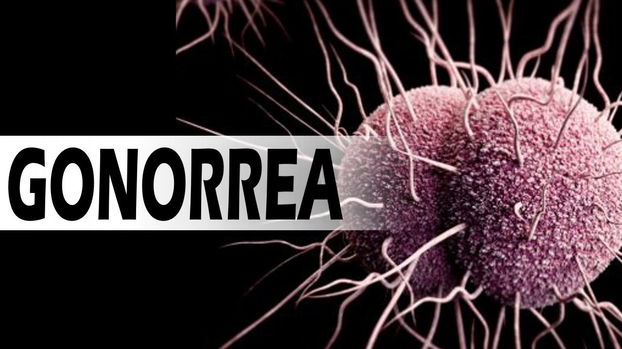 GONORREA