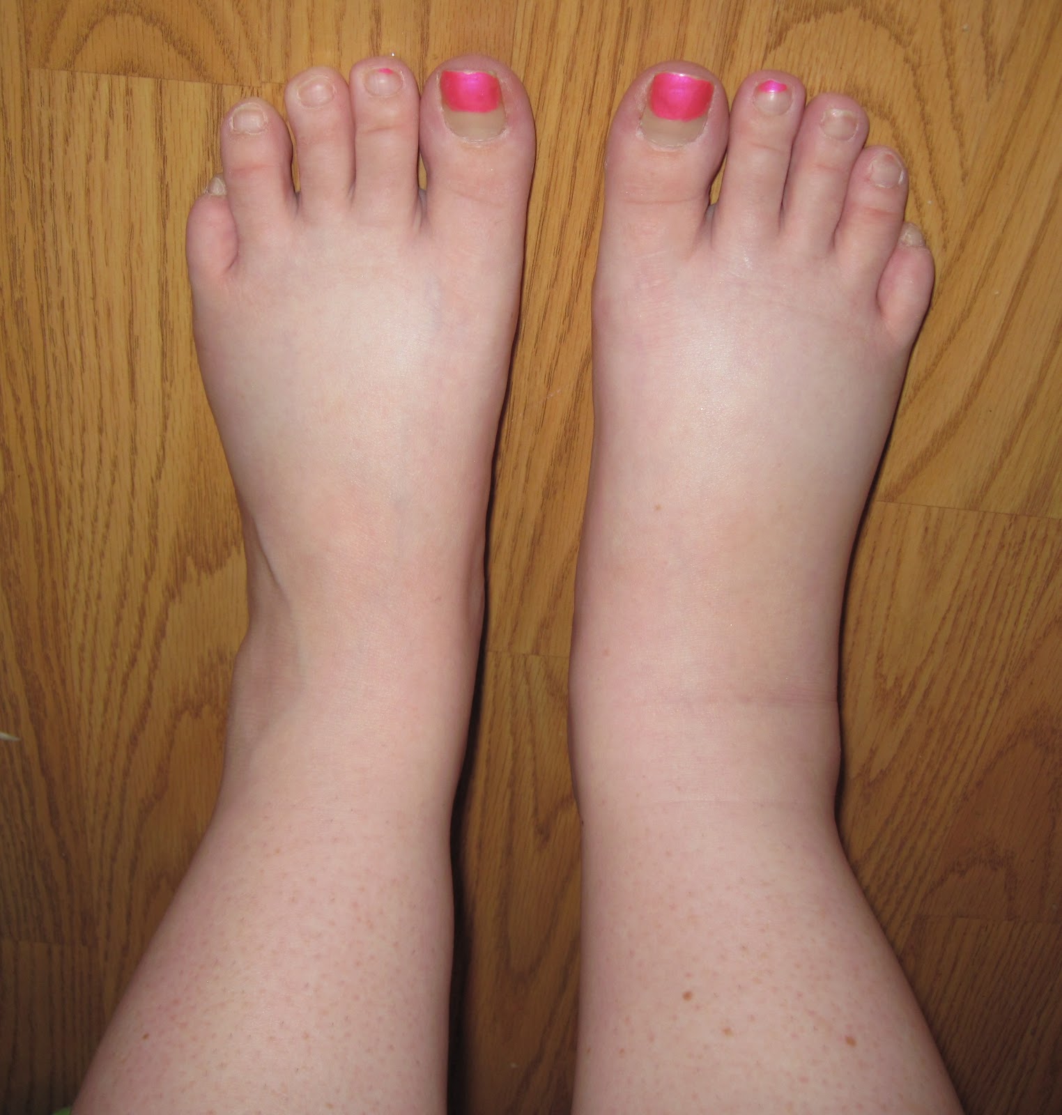 of feet Pictures fat
