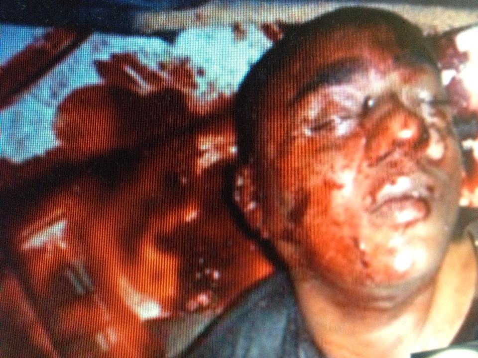 Herido habría revelado quien lo mandó a matar en Cafetería