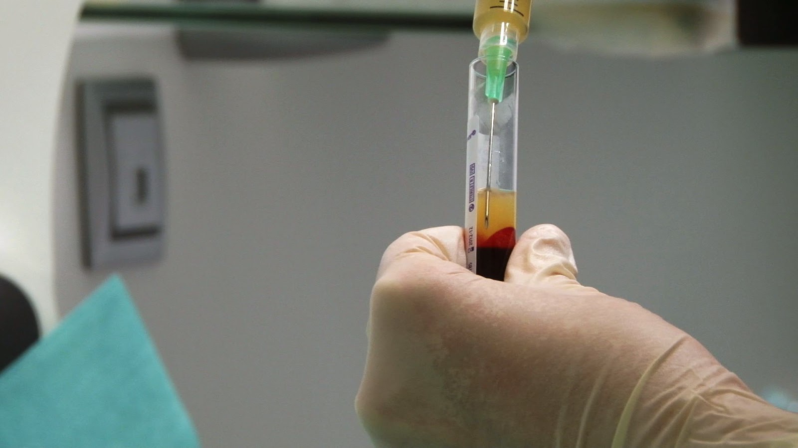 Dra. Elizabeth Cabanillas: PLASMA RICO EN PLAQUETAS EN CUERO CABELLUDO