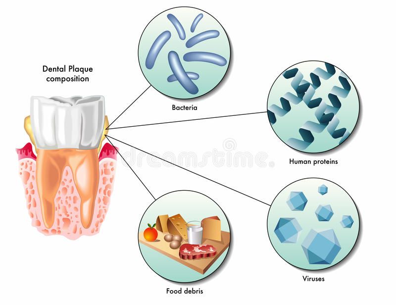 Placa dentobacteriana