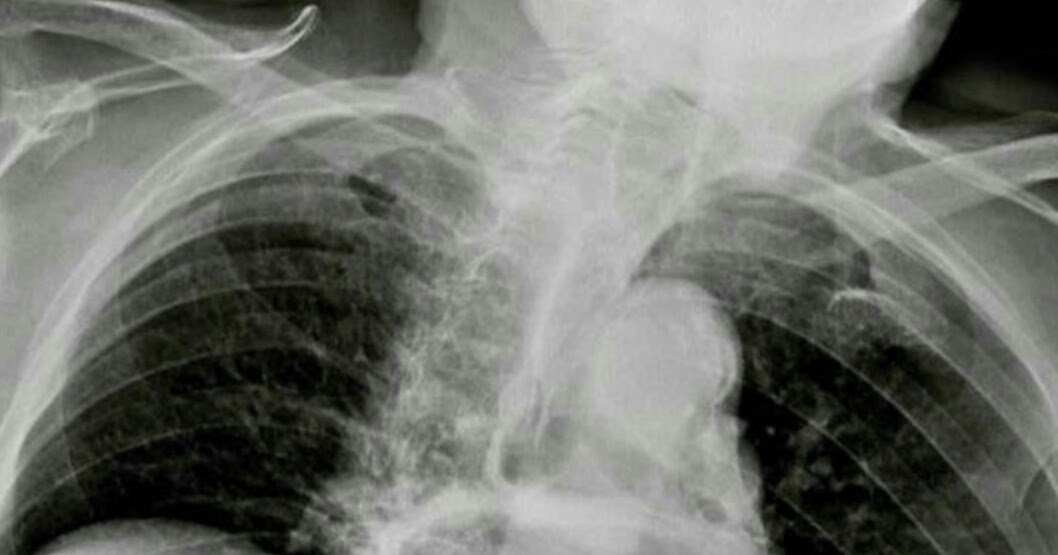 Cuantas radiografías se pueden hacer al día