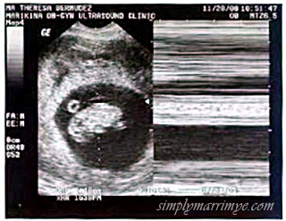 Ultrasound result dated nov. 14, 2008