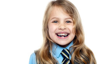 Niềng răng trẻ em có tốt không?