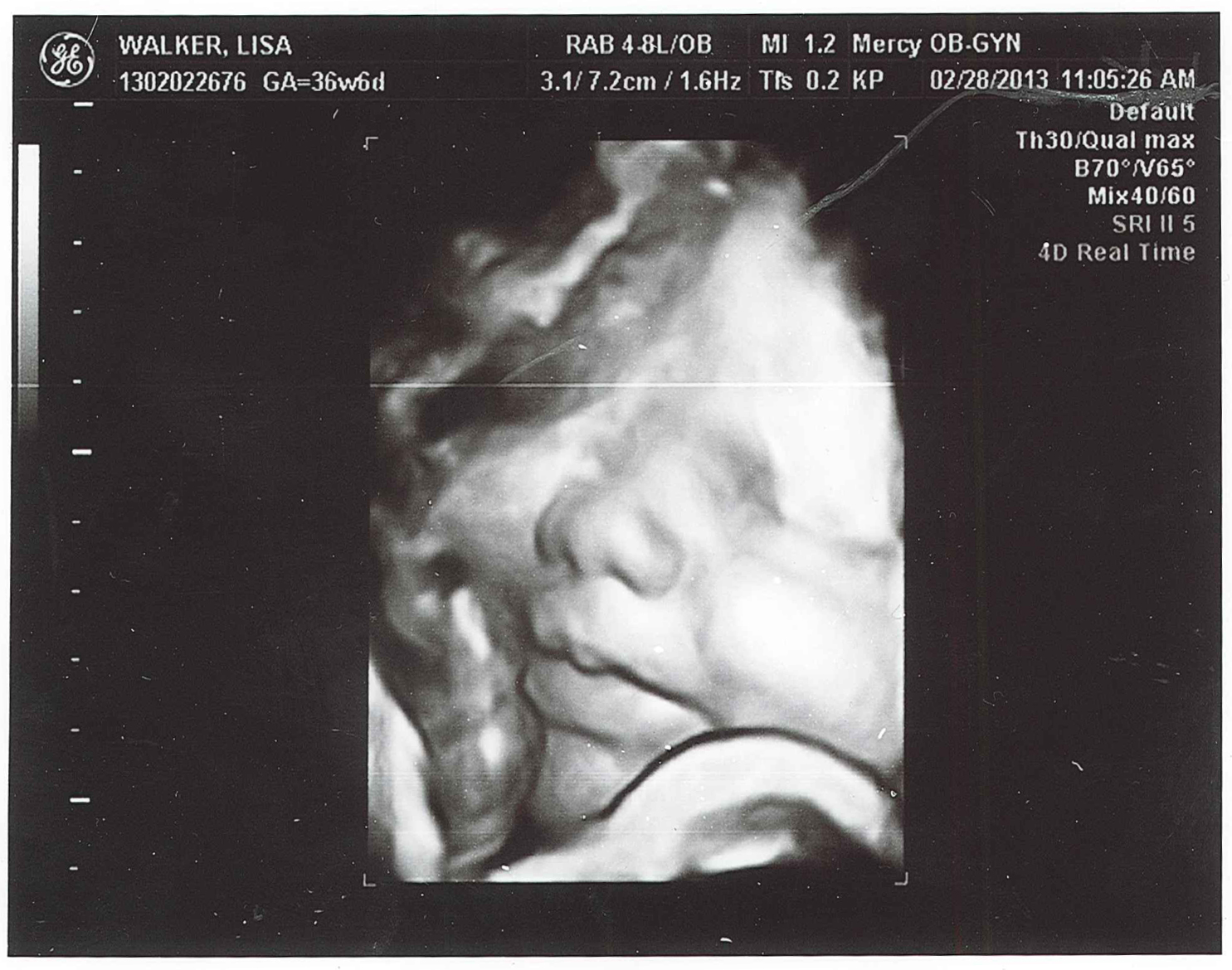 Pages From The Pursuit Photos Baby Boy Ultrasound At 37 Weeks