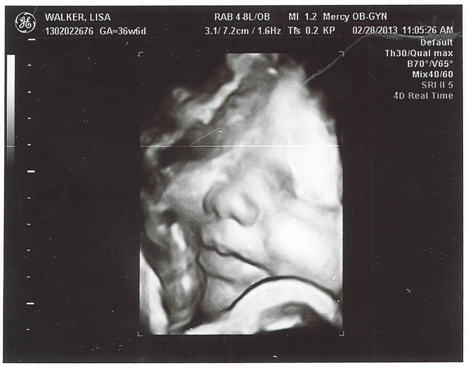 Pages From the Pursuit Photos Baby Boy Ultrasound at 37 weeks