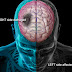 STROKE,KNOW THE SIGNS!