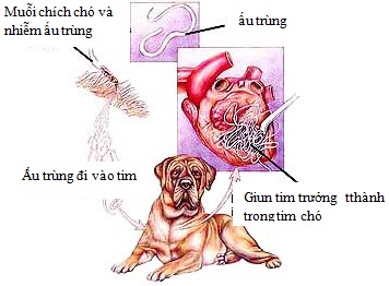 oxiuros manejo pediatria bladder papilloma histopathology