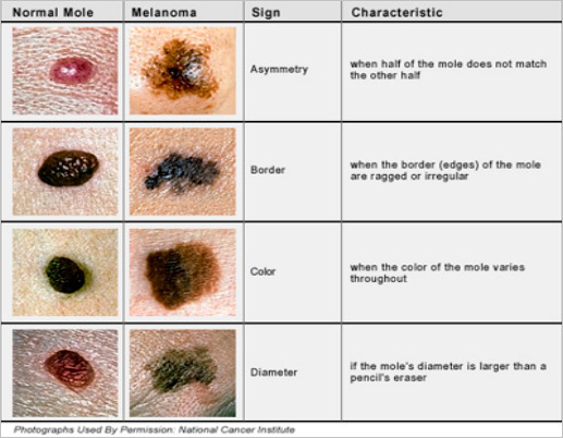 Description, Definition and Diagnosis of Common Skin Rashes