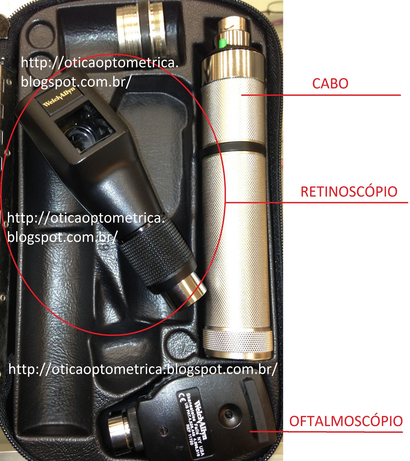Optometria e Técnicas com pratica em ótica Retinoscopia_PARTE 1