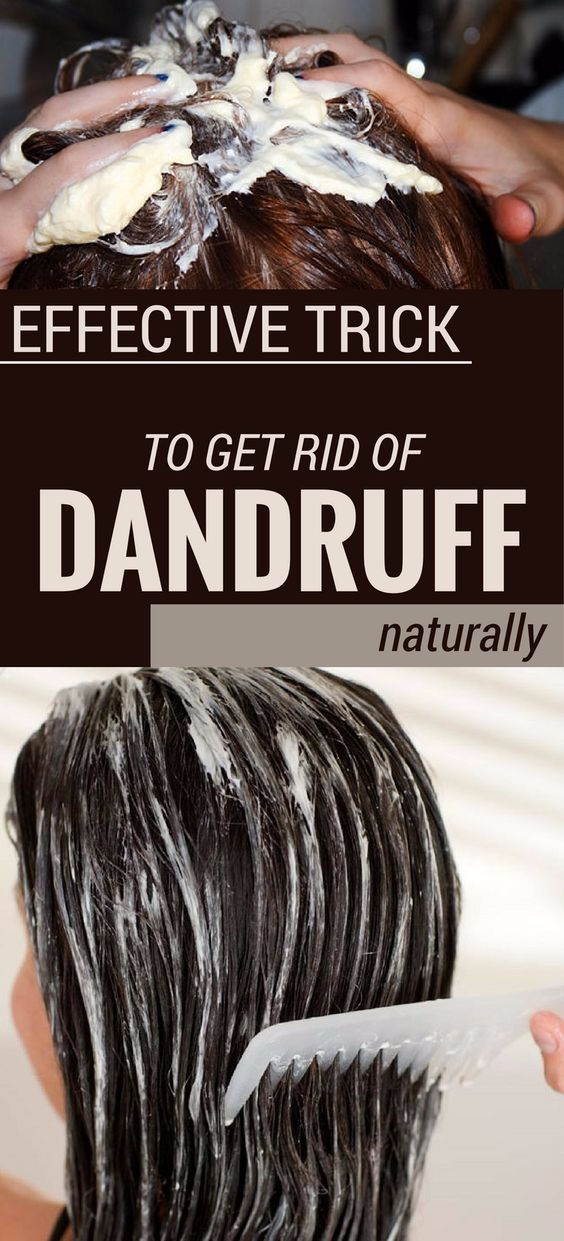 EFFECTIVE TRICK TO GET RID OF DANDRUFF NATURALLY HEALTH BLOG
