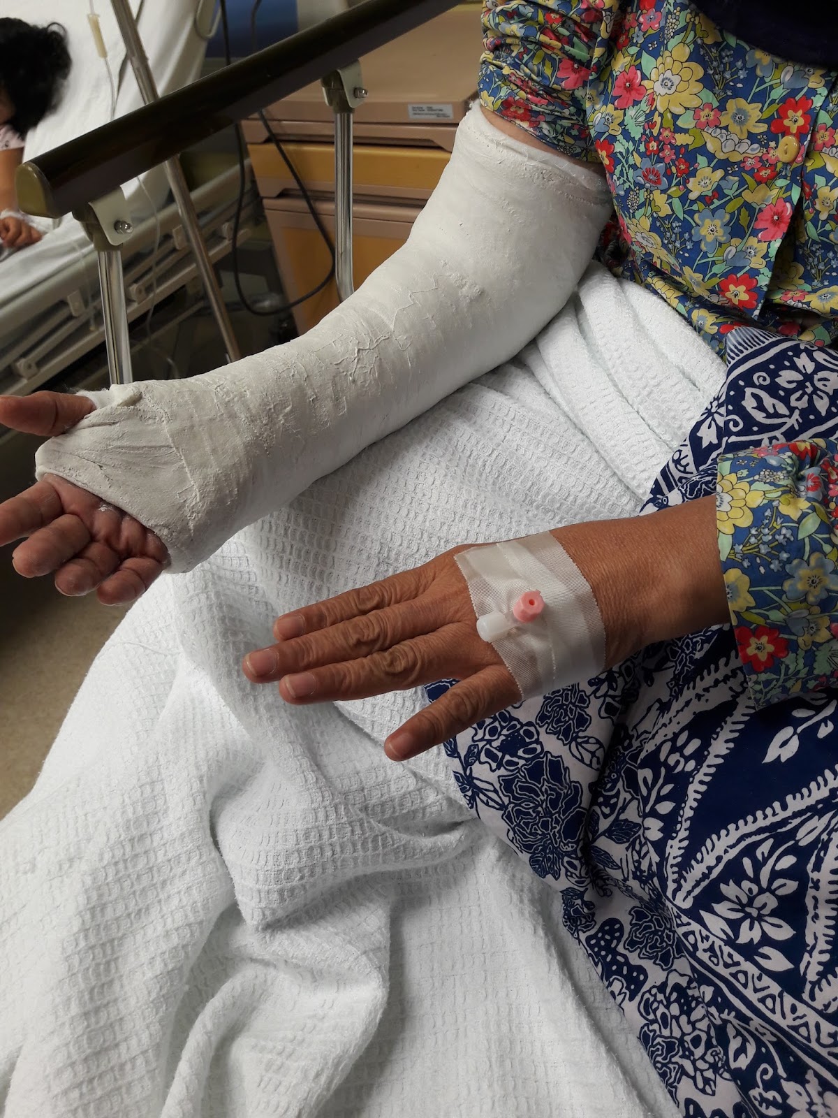 Ceritera FLK: Mama Jatuh dan patah pergelangan tangan kanan