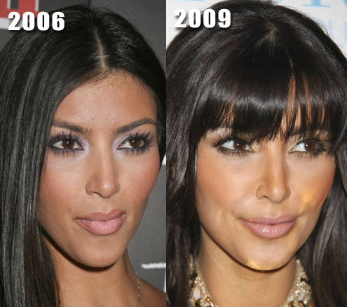 Kim Kardashian Plastic Surgery Before And After - Plastic Celebrity Surgery