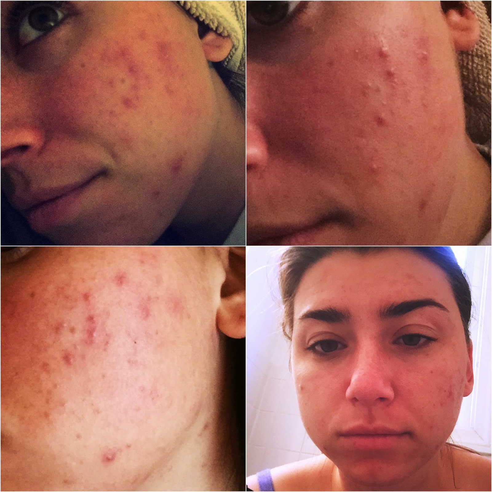 Makeup Artist's Choice Before/After Pics and Testimonials