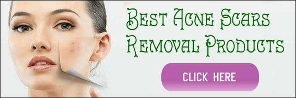 Best Acne Scars Removal Products Natural