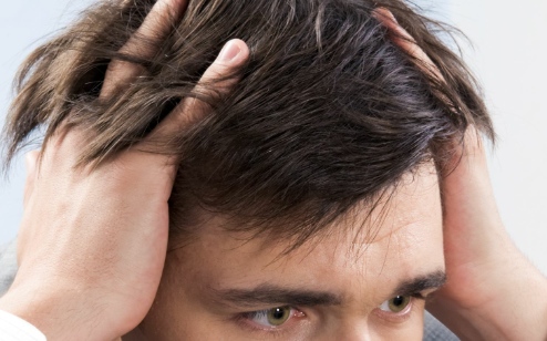 How To Reverse Hair Loss Naturally