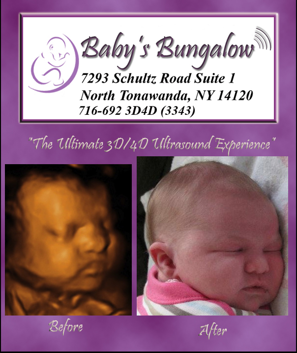 Baby's Bungalow 3D Ultrasound Buffalo 4D Ultrasound