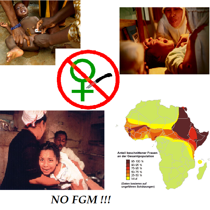 Обрезание у девочек схема для чего. Как выглядит женское обрезание. Женское обрезание в Африке.