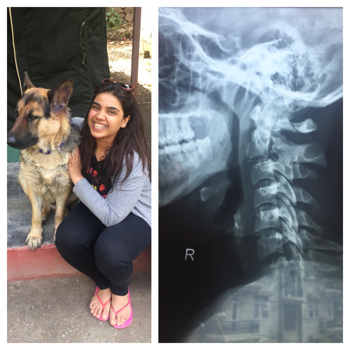 The Girl With The Broken Neck How to break your neck in FIVE STEPS